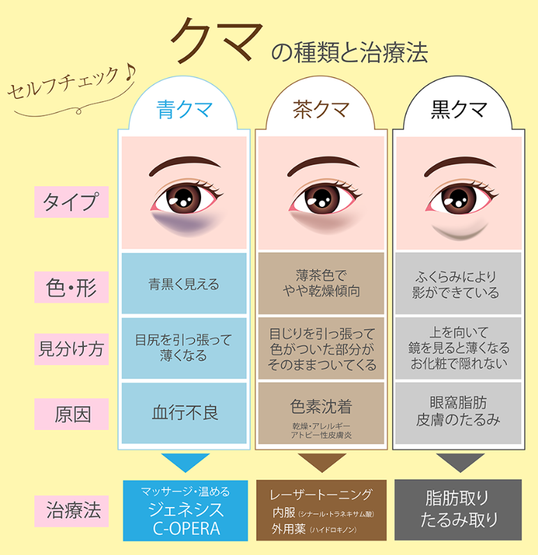 3種類の『クマ』のタイプ